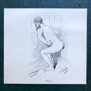 Fig. 2. Print from “The Treatment of Tabetic Ataxia by Means of Systematic Exercise” by Dr. H. S. Frenkel